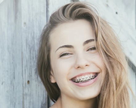 Jak działa żel łagodzący na rany i otarcia od aparatu ortodontycznego?